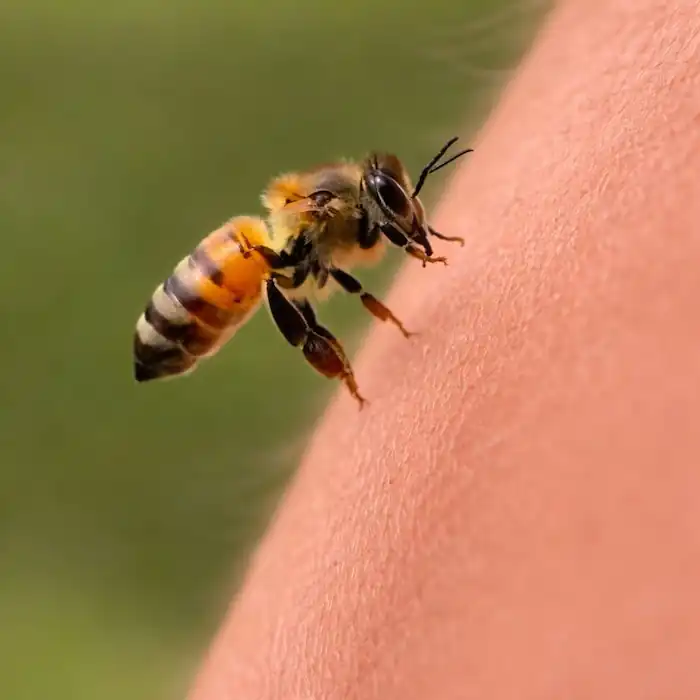 Do Honey Bees Sting? Causes, Symptoms, and Treatment 2 Macro image of a honey bee stinging human skin, with the stinger making contact